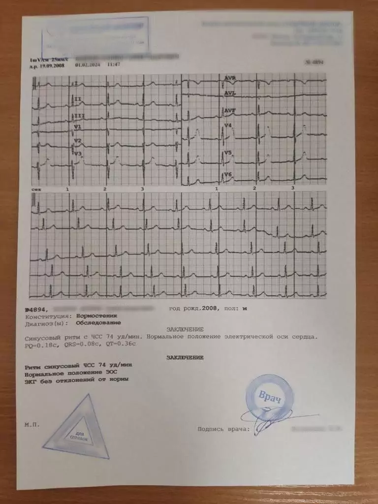 Купить заключение ЭКГ